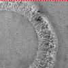 Toward Mini-Pancreas: Micropatterned electrospun scaffolds enabling cell transplantation for treating diabetes