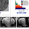 工学院生物医学工程系段小洁课题组及合作者在MRI兼容神经电极及DBS-fMRI联用揭示DBS对大脑调制效应方面取得重要进展